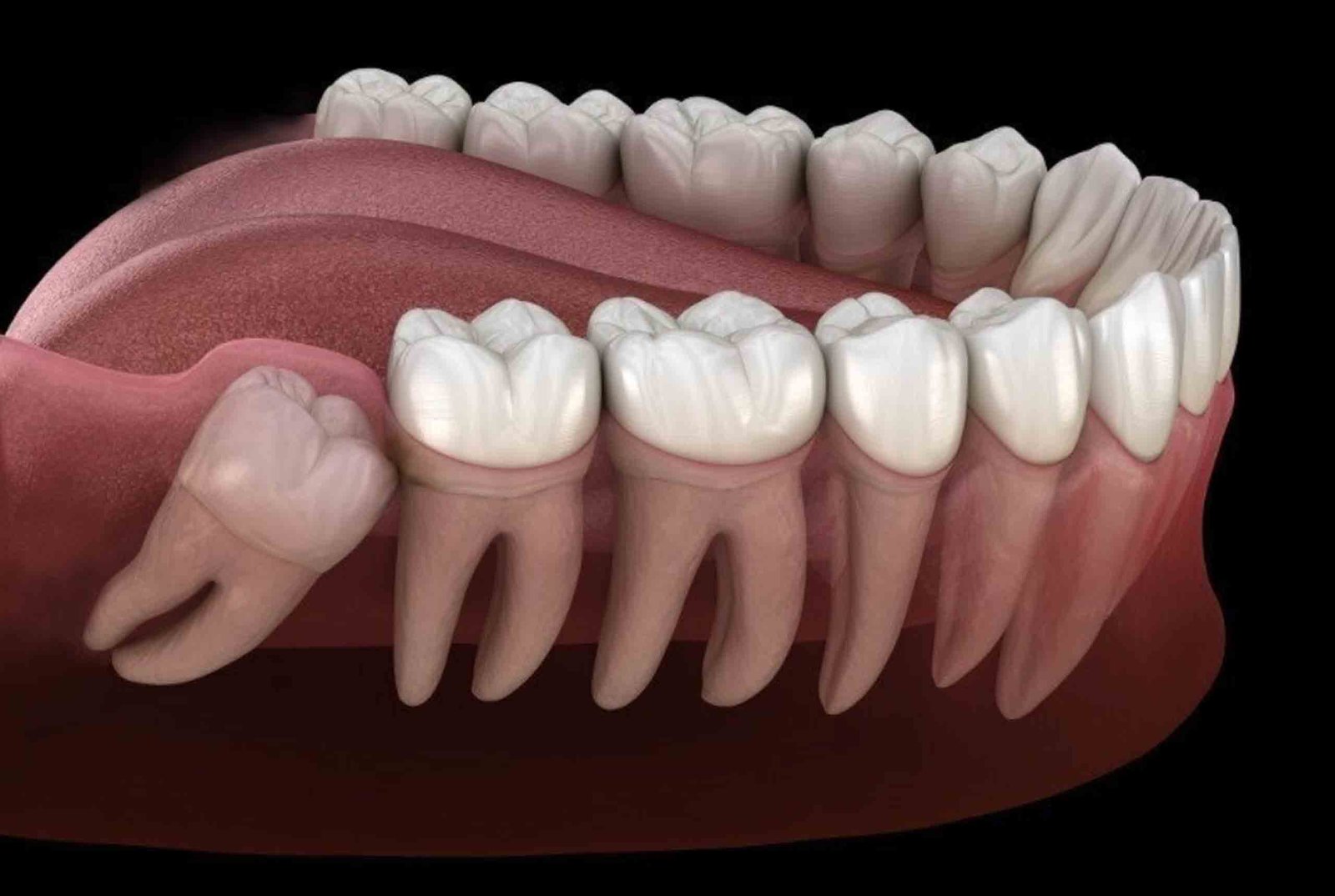Minor Oral Surgeries
